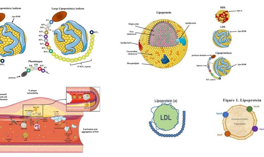 Lipoprotein a [ Lp(a) ]  